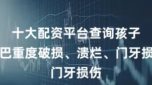 十大配资平台查询孩子嘴巴重度破损、溃烂、门牙损伤